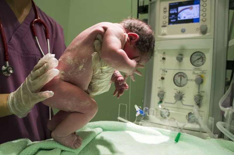 剖腹产的宝宝容易患多动症吗剖腹产给孩子带来的六大危害