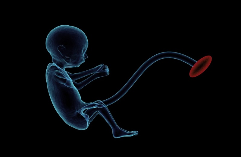 生下性染色体异常胎儿会有什么症状染色体异常是怎么回事